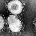 Il Virus cinese arriva in Europa, tre casi in Francia: cosa ci stanno nascondendo dalla Cina?